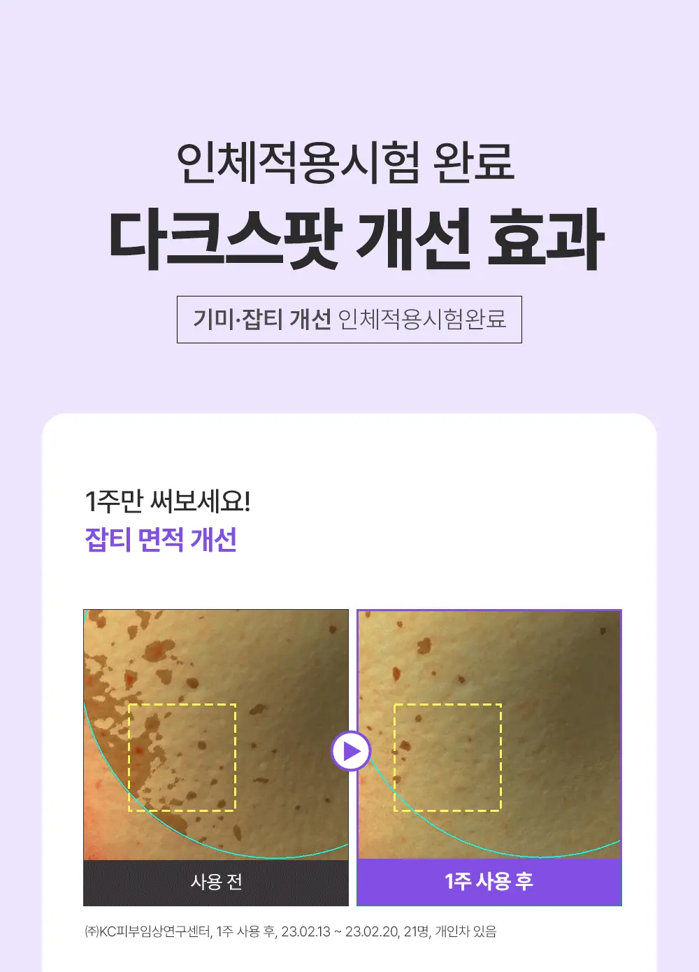 [잡티미백케어] 성분에디터 머루포도 비타 C 잡티크림 50g 상세페이지 29